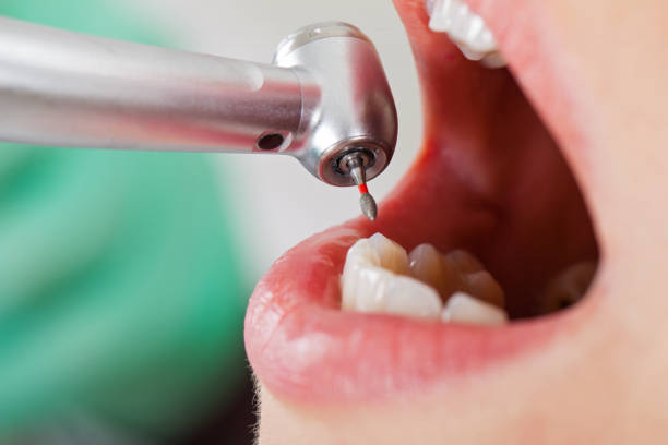 Best Emergency Denture Repair in Cloverdale, IN